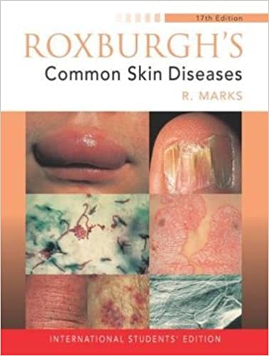 (ex)(old)roxburgh's Common Skin Diseases