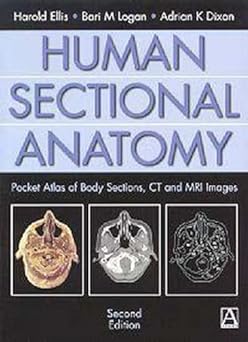 (old)human Sectional Anatomy Pocket Atlas Of Body Sections, Ct And Mri Images