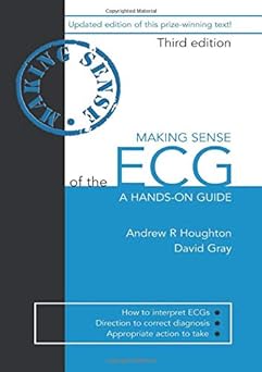 (old)making Sense Of The Ecg A Hands-on Guide