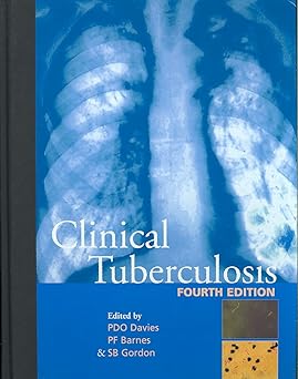 (old)clinical Tuberculosis