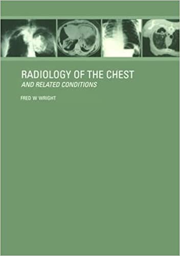 Radiology Of The Chest And Related Conditions With Cd-rom
