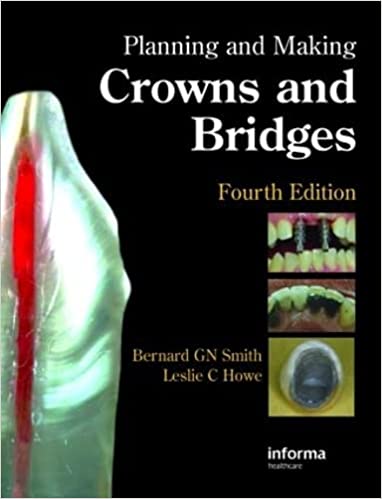 (ex)planning And Making Crowns And Bridges