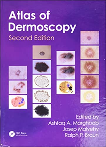(ex)atlas Of Dermoscopy
