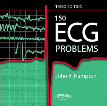 (old)150 Ecg Problems