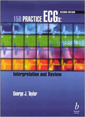 (ex)150 Practice Ecgs Interpretation And Review