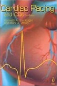 (old)cardiac Pacing And Icds