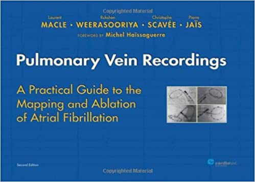 (ex)pulmonary Vein Recordings:a Practical Guide To The Mapping And Ablation Of Atrial Fibrillation