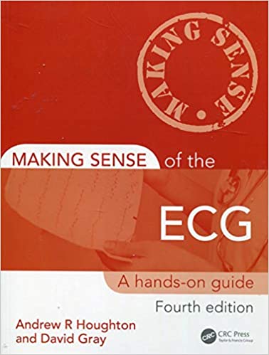 Making Sense Of The Ecg A Hands-on Guide