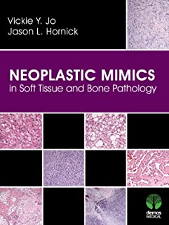 Neoplastic Mimics In Soft Tissue And Bone Pathology