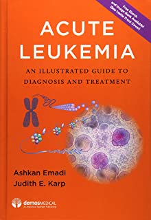 Acute Leukemia: An Illustrated Guide To Diagnosis And Treatm