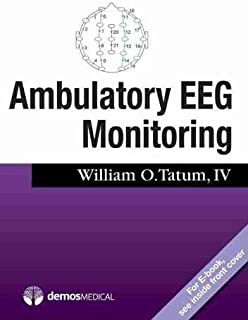 Ambulatory Eeg