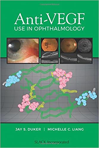 Anti-vegf Use In Ophthalmology