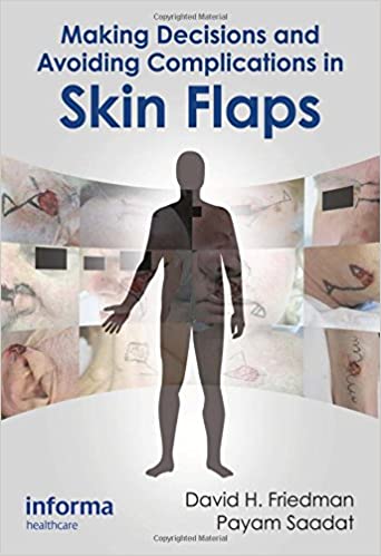 (ex)making Decisions And Avoiding Complications In Skin Flaps