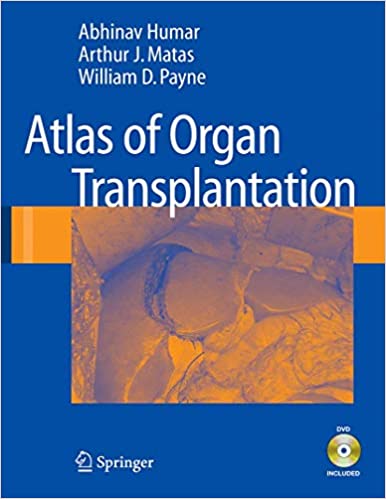 (ex)atlas Of Organ Transplantation Dvd Included