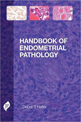 Handbook Of Endometrial Pathology