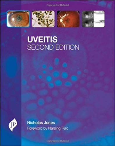 Uveitis With Cd-rom