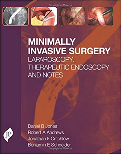 Minimally Invasive Surgery Laparoscopy,therapeutic Endoscopy And Notes