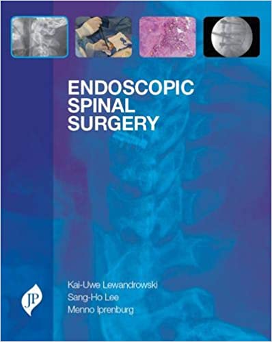 Endoscopic Spinal Surgery