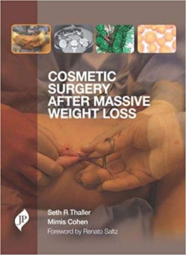 Cosmetic Surgery After Massive Weight Loss