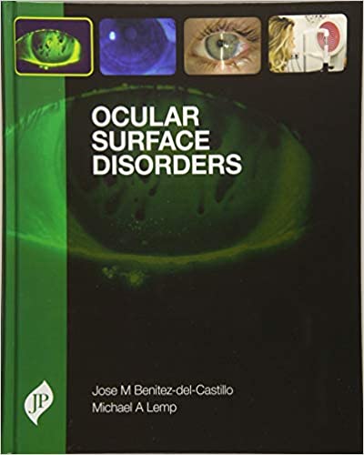 Ocular Surface Disorders