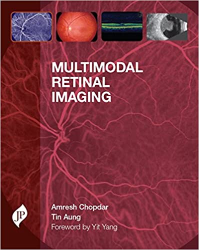 Multimodal Retinal Imaging