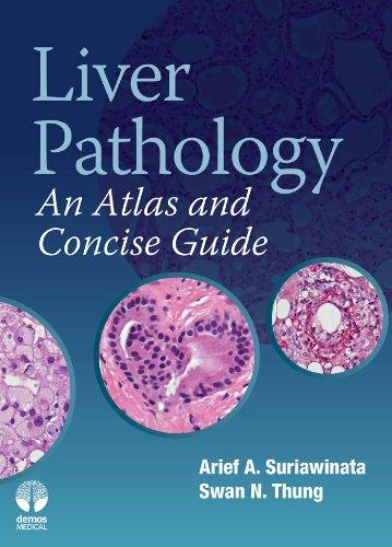 (ex)liver Pathology An Atlas And Concise Guide