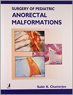 Surgery Of Pediatric Anorectal Malformations