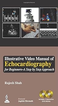 (old)illustrative Video Manual Of Echocardiography A Step By Step Approach Part 1 Includes 2 Dvd-rom