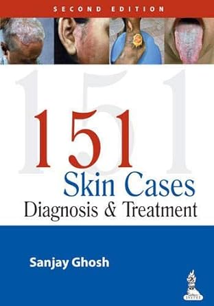 (old)151 Skin Cases Diagnosis & Treatment