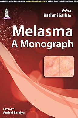 (old)melasma :a Monograph