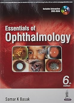 (old) Essentials Of Ophthalmology