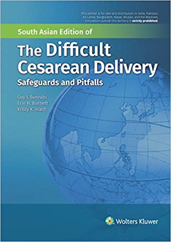 The Difficult Cesarean De+c275:c294livery Safeguards And Pitfalls
